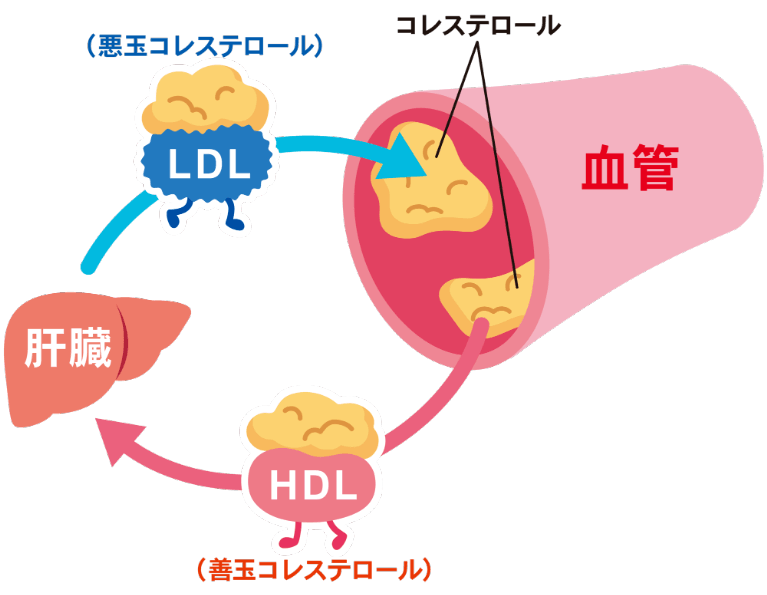 【2026年最新】血管を救う「一杯」の選び方：コレステロールを下げる飲み物の科学と落とし穴